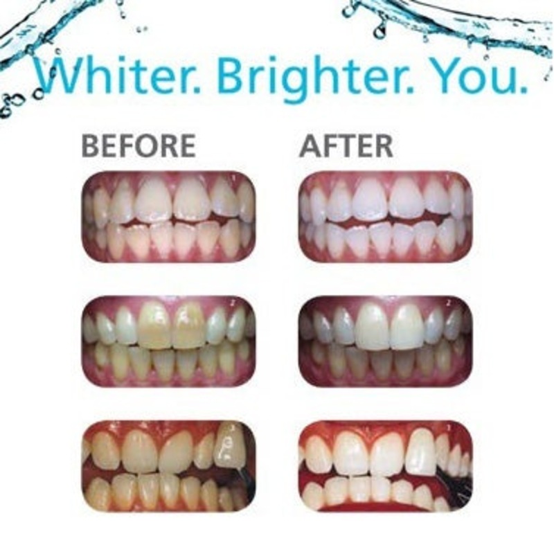 Polanight 18 Carbamide Peroxide Whitening Gel 3 x 3gram Syringes, Shade Guide and Instructions