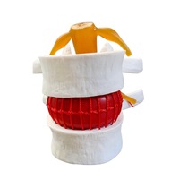 Human Anatomy Skeleton Spine Lumbar Herniation Teaching Model Medical Science Education