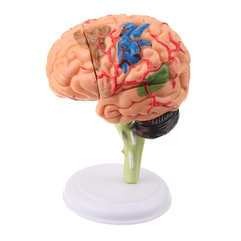 Buy Human Brain Medical Model 4D Disassembled Anatomical School ...