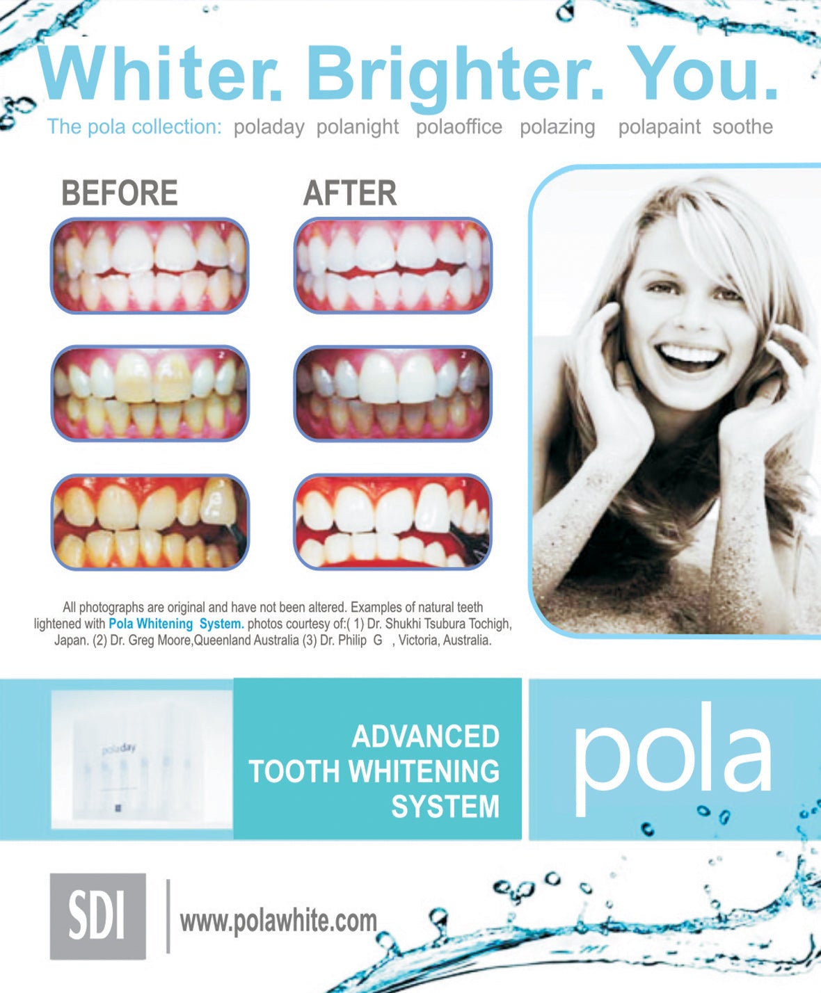 polanight sdi teeth whitening gel