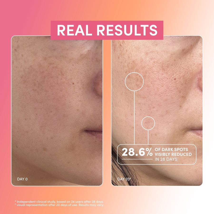 essano Vitamin C 15% Advance C+ Complex Super Serum