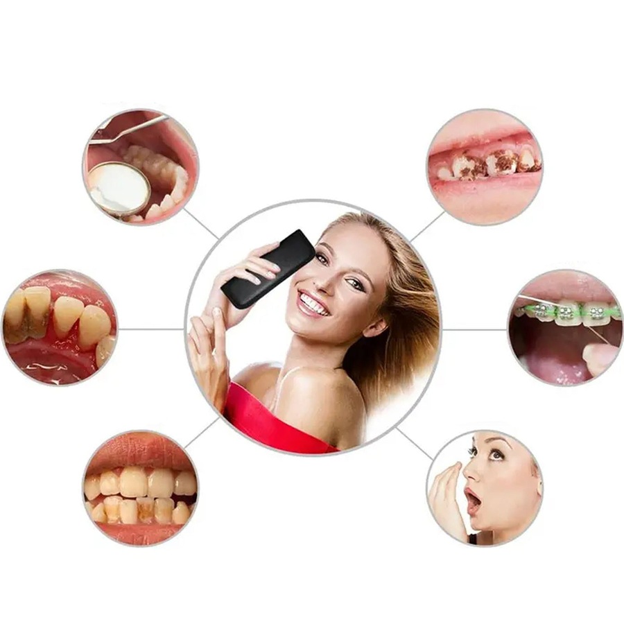 Stainless Dental Tool Set Kit Dentist Teeth Clean Hygiene Oral - 7pcs