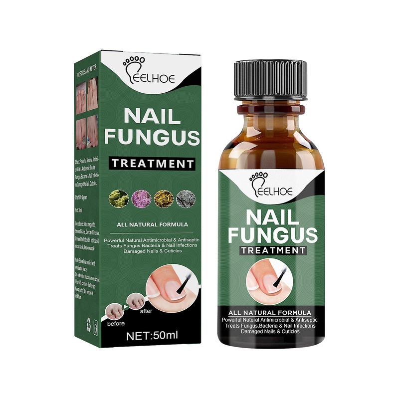 Buy Nail Fungus Treatment, 50ml Toenail Fungus Treatment, Extra