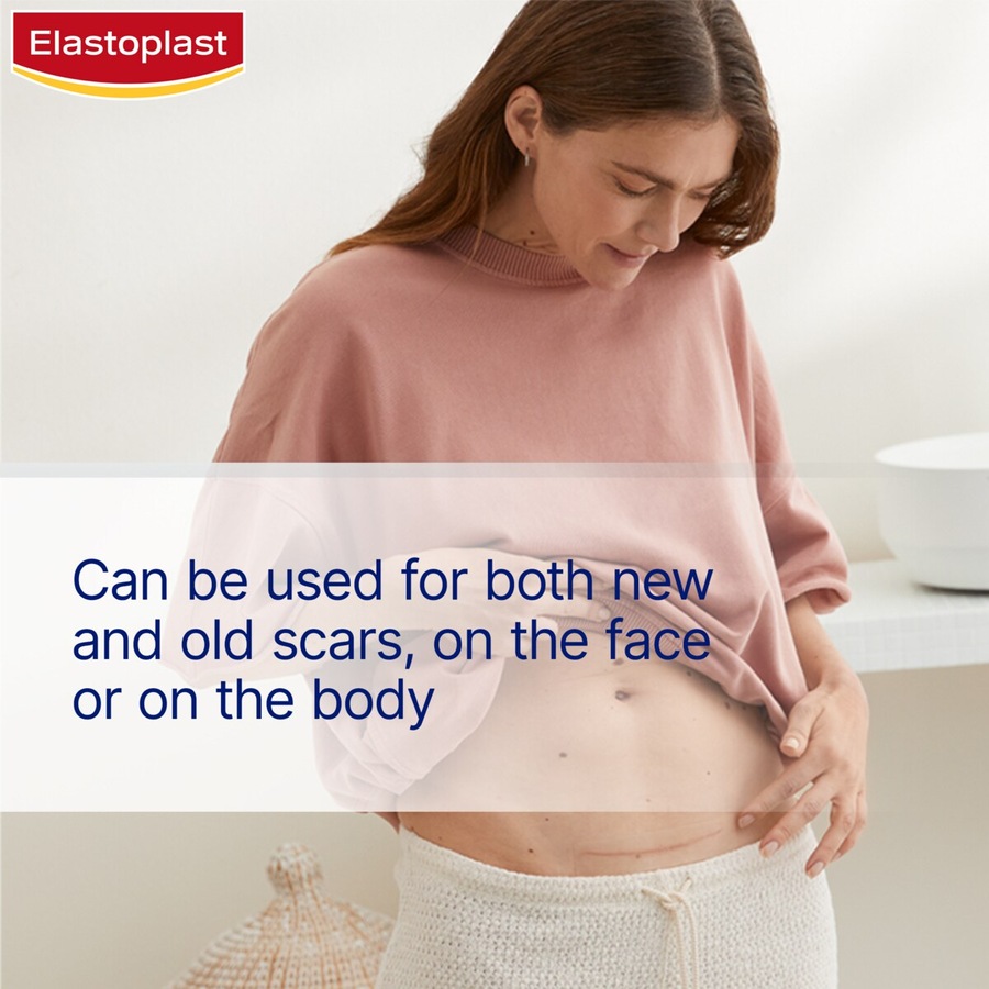 Elastoplast Scar Reducer Patches 21 Pack