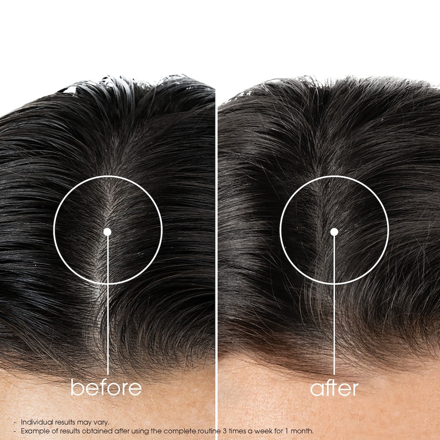 Klorane Hair Strengthening Serum with Quinine & Organic Edelweiss 100ml