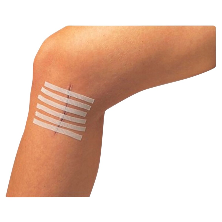 Leukostrip Wound Closure Strips 6.4mm x 76mm - Single (3 Strips)